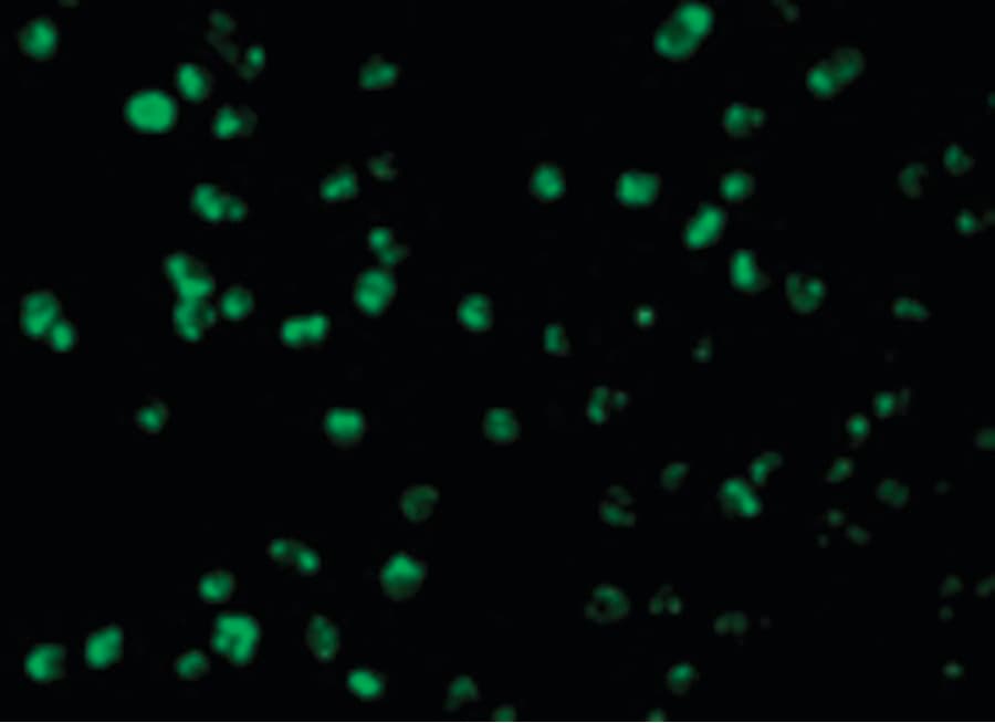 IHC-plus™ Polyclonal Rabbit anti-Human MCL1 / MCL 1 Antibody (IHC, IF, WB)