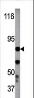 IKBKB / IKK2 / IKK Beta Antibody (phospho-Tyr199)