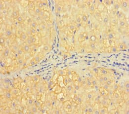 Polyclonal Rabbit anti-Human H2AFB1 Antibody