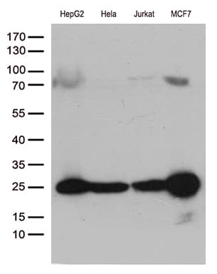 MGMT Antibody (clone OTI6G6)