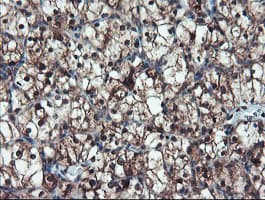 TRAIP / TRIP Antibody (aa67-313, clone OTI2D4, Carrier-free)