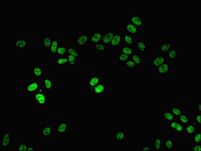 PPP1R8 / Rnase E Antibody