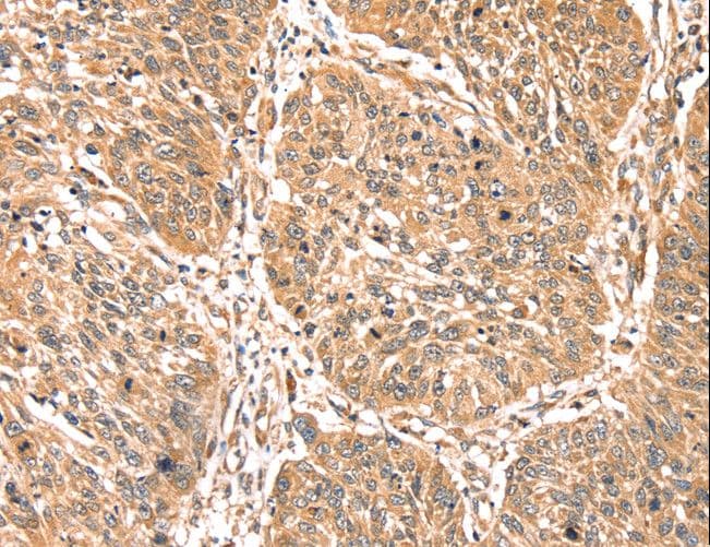 PDLIM4 / RIL Antibody