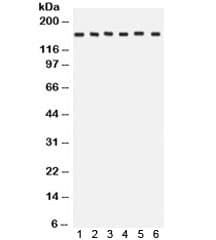 ROCK2 Antibody