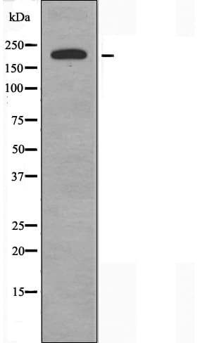 COL5A1 / Collagen V Alpha 1 Antibody