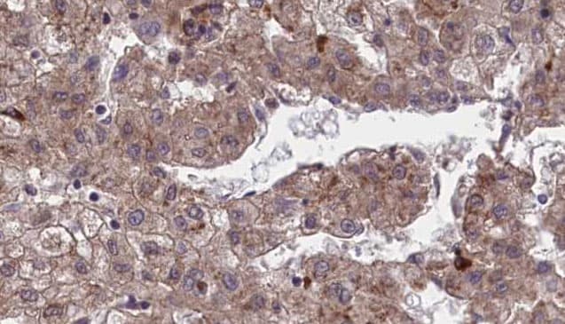 OR1J4 Antibody
