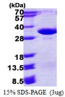 Human PSMA4 Protein (Recombinant His)