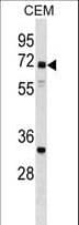 Polyclonal Rabbit anti-Human NPLOC4 Antibody (aa456-484, WB)