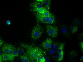 ATP5B / ATP Synthase Beta Antibody (clone OTI1F7, Carrier-free)