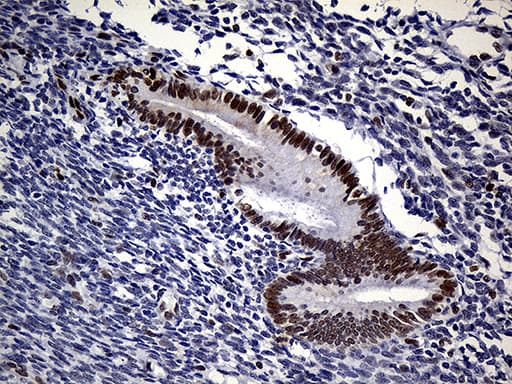 RB1 / Retinoblastoma / RB Antibody (aa309-590, clone OTI13A6)