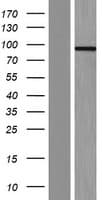 CCHCR1 Protein (Over-Expression Lysate Myc-DDK (Flag))