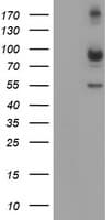IHC-plus™ CAPN2 / Calpain 2 / M-Calpain Antibody (clone 1F4)