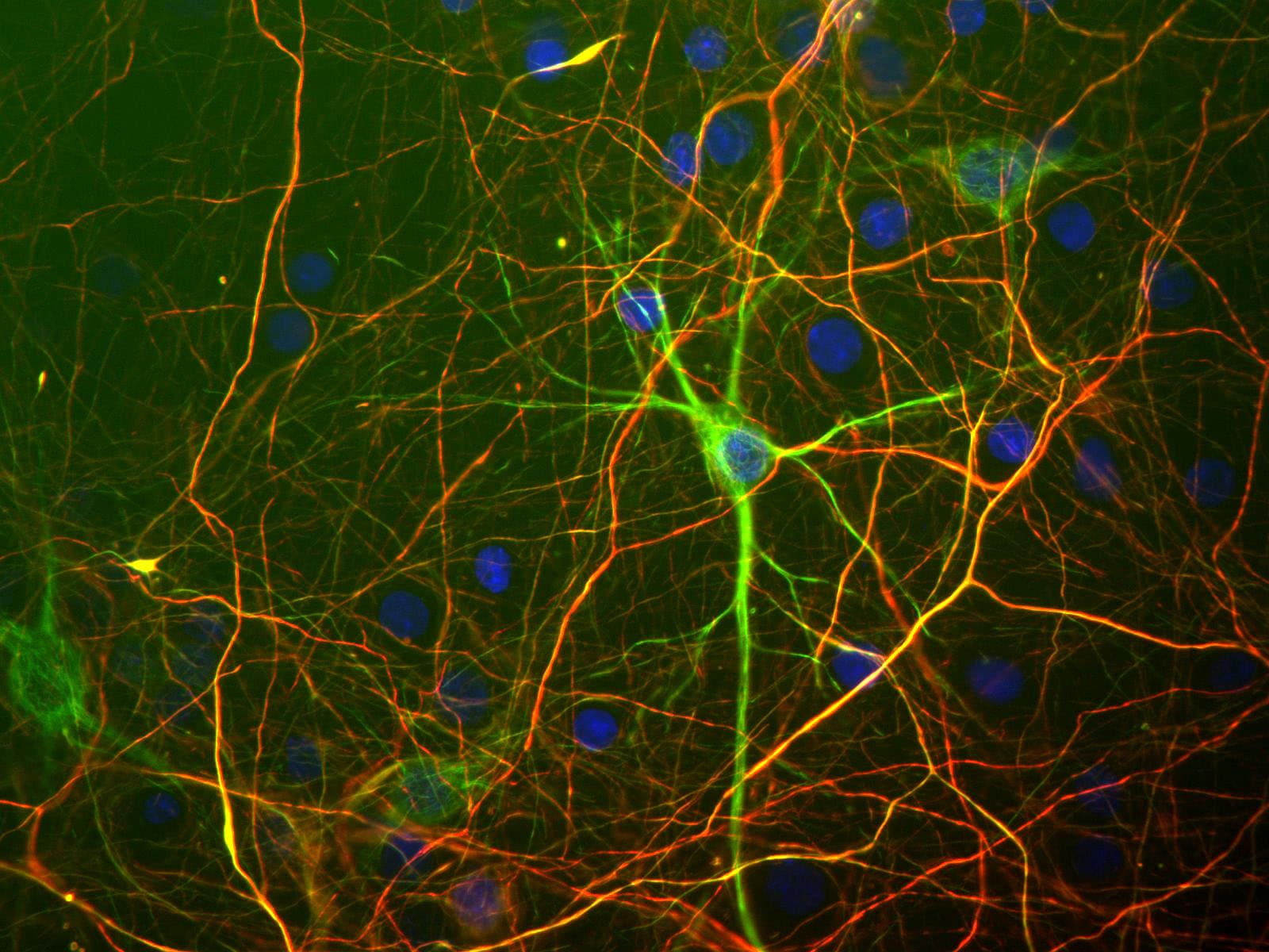 NEFH / NF-H Antibody
