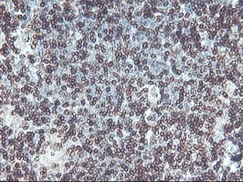 APMAP / C20orf3 Antibody (clone OTI1A9)