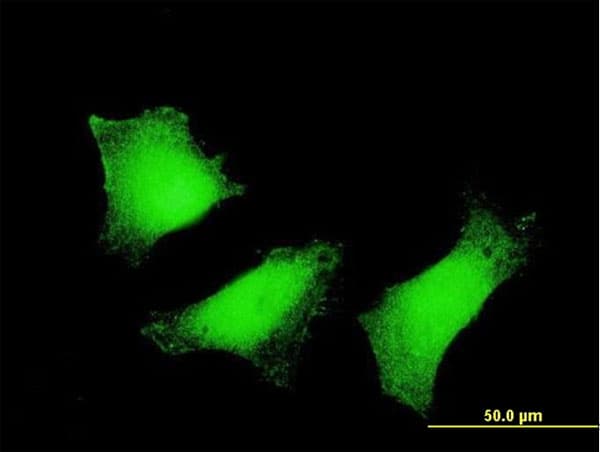 TGM2 / Transglutaminase 2 Antibody (clone 2F4)
