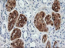 ACY1 / Aminoacylase 1 Antibody (clone OTI16C1)