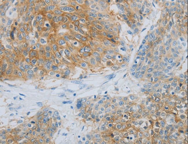 Polyclonal Rabbit anti-Human NDRG1 Antibody (IHC, WB)