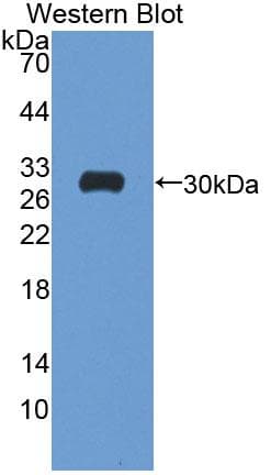 ATP1B4 Antibody (aa132-356)