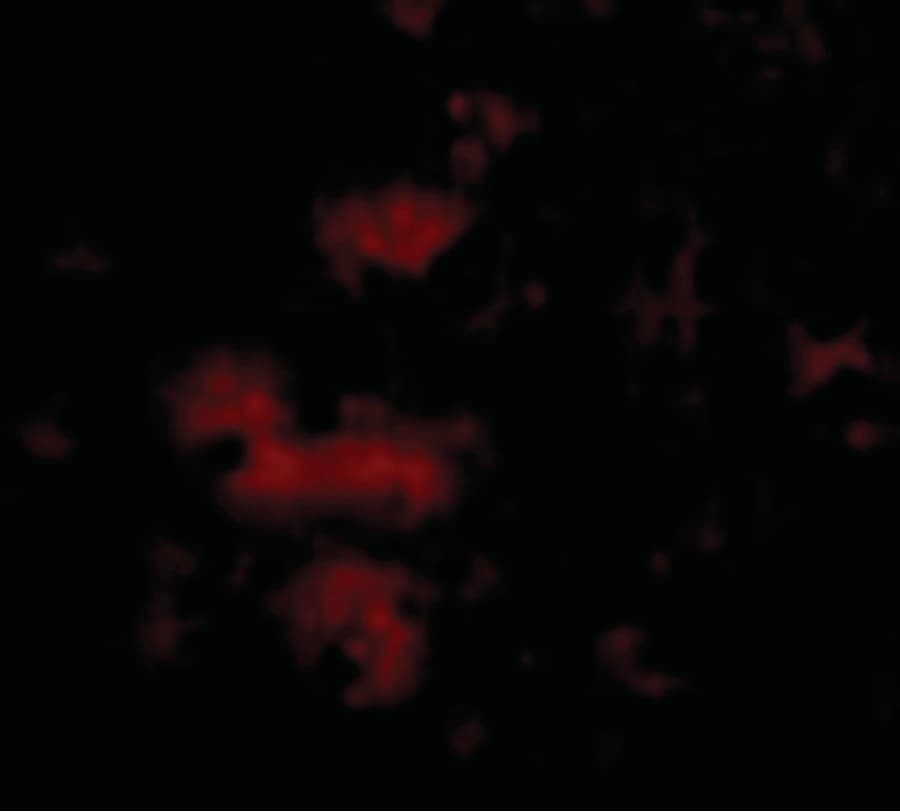 IHC-plus™ STIM2 Antibody