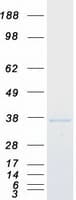 Human SIP1 Protein (Recombinant Myc-DDK (Flag))