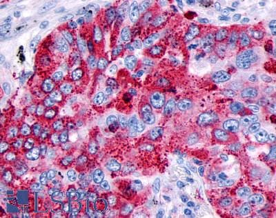 PathPlus™ ADGRD1 / GPR133 Antibody (Cytoplasmic Domain)
