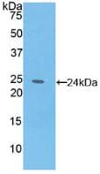 IL6 / Interleukin 6 Antibody (aa30-208)
