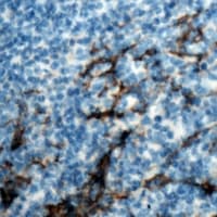 Polyclonal Rabbit anti-Human ANPEP / CD13 Antibody (C-Terminus, IHC, WB)