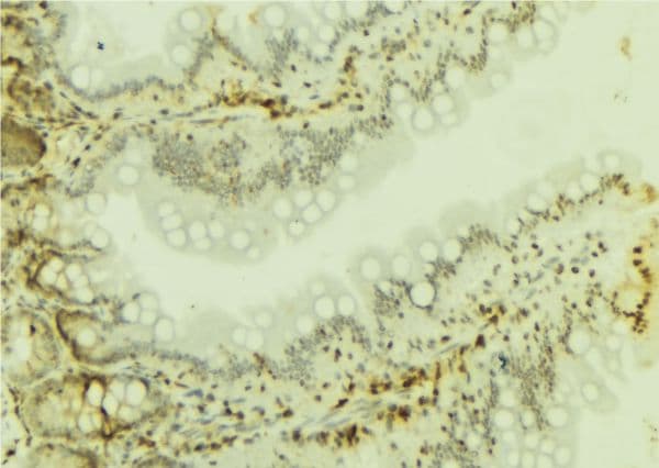 Polyclonal Rabbit anti-Human SMARCA4 / BRG1 Antibody (IHC, WB)