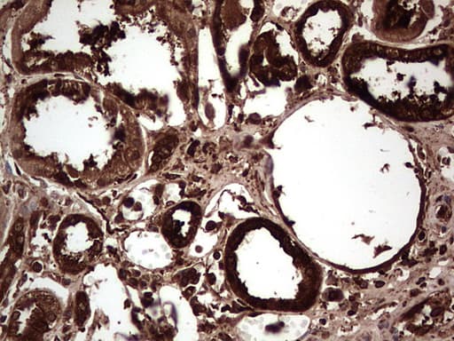 PKM2 Antibody (clone OTI12D5, Carrier-free)