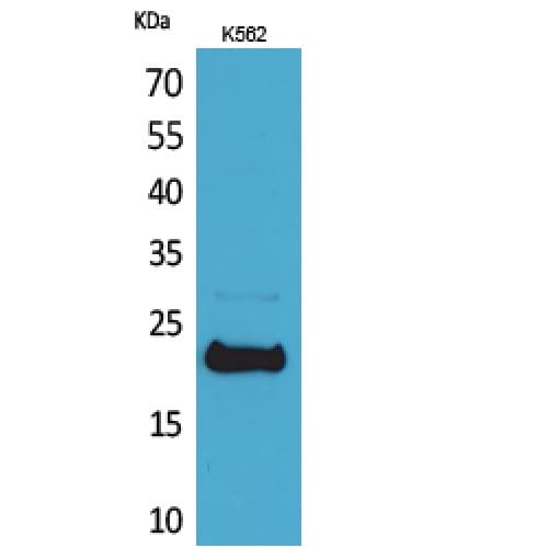 Polyclonal Rabbit anti-Human LIF Antibody (141-190 aa, C-terminal, WB)
