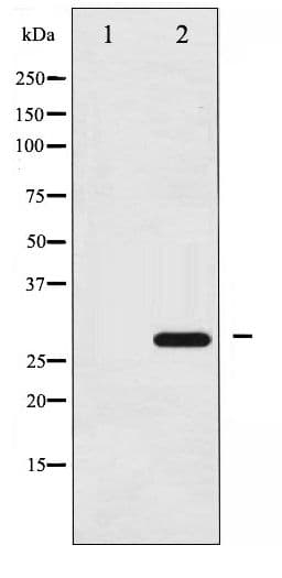 YWHAZ / 14-3-3 Zeta Antibody (phospho-Ser58)