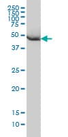 Monoclonal Mouse anti-Human HARS Antibody (clone 1C8, IF, WB)