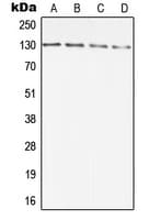DIAPH2 Antibody (Internal)