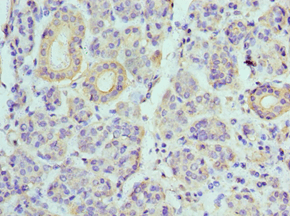 IHC-plus™ Polyclonal Rabbit anti-Human ATP6V1B1 Antibody (aa1-280, IHC, WB)