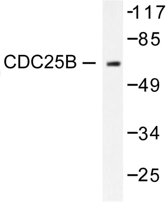 CDC25B Antibody (Arg317)