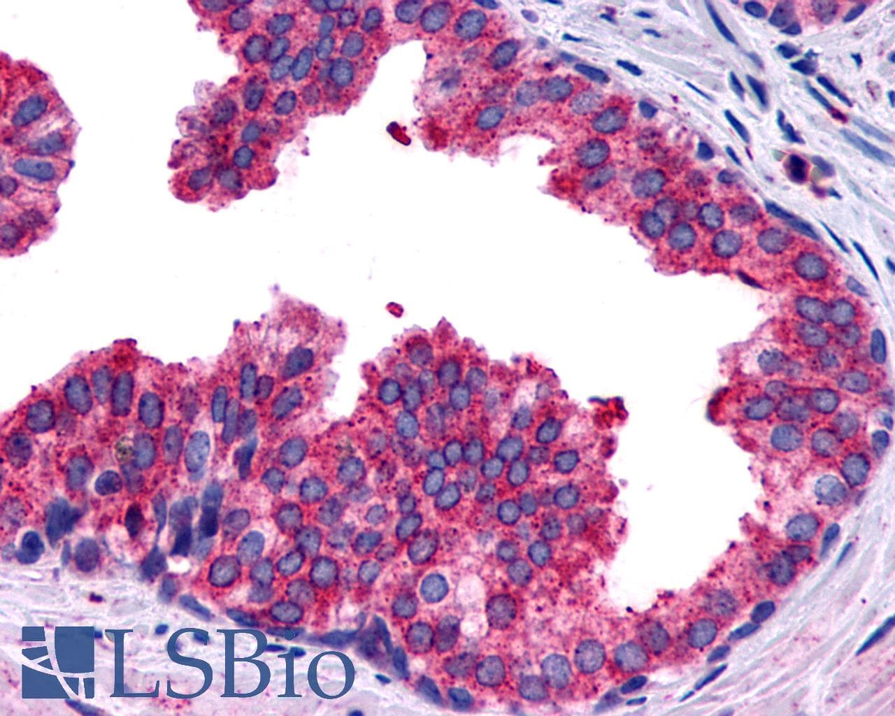 PathPlus™ Polyclonal Rabbit anti-Human PTGER4 / EP4 Antibody (C-Terminus, IHC)