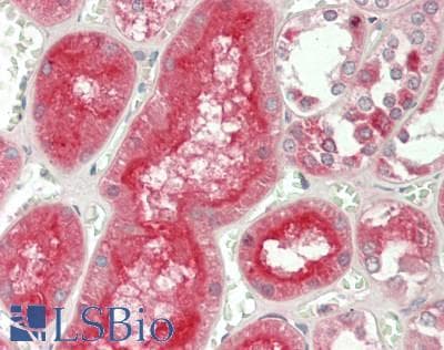 PathPlus™ Polyclonal Rabbit anti-Human ADAM10 Antibody (aa420-641, IHC, WB)