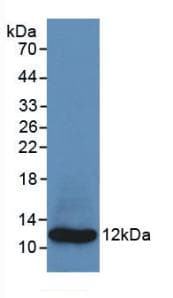 S100A8 / MRP8 Antibody (aa1-93)