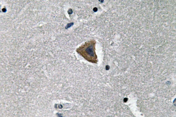 Polyclonal Rabbit anti-Human Rho Kinase / ROCK1 Antibody (aa262-311, IHC, WB)