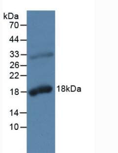 KLK2 / Kallikrein 2 Antibody (aa19-261, Biotin)