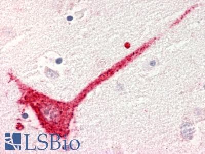 PathPlus™ Polyclonal Rabbit anti-Human GPR182 / ADMR Antibody (Cytoplasmic Domain, IHC)