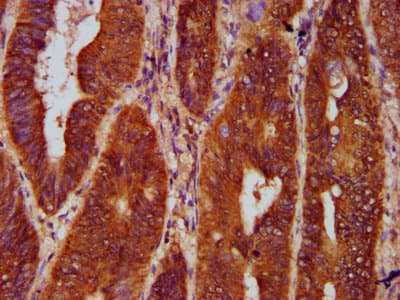Gephyrin Antibody