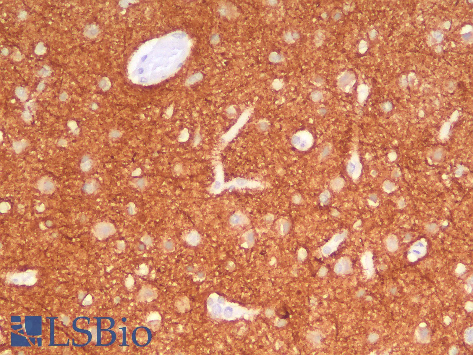 PathPlus™ NF-L / NEFL Antibody (clone NEFL/2983R)