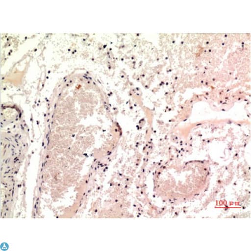 TUBG1 / Tubulin Gamma 1 Antibody