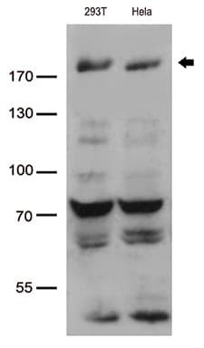 Monoclonal Mouse anti-Human BAZ1B / WSTF Antibody (clone OTI3B8, Carrier-free, aa1-260, WB)