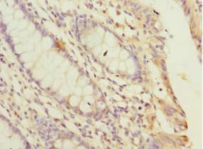 PPP2R5C Antibody