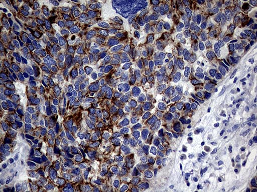 KRT18 / CK18 / Cytokeratin 18 Antibody (aa69-372, clone OTI10G8)
