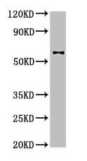 Polyclonal Rabbit anti-Human DPYSL2 / CRMP2 Antibody (IHC, IF, WB)