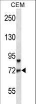 FOXO3 / FOXO3A Antibody (aa224-253)