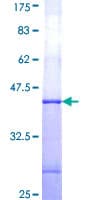 Human GUCY2F Protein (Recombinant GST, N-terminus)